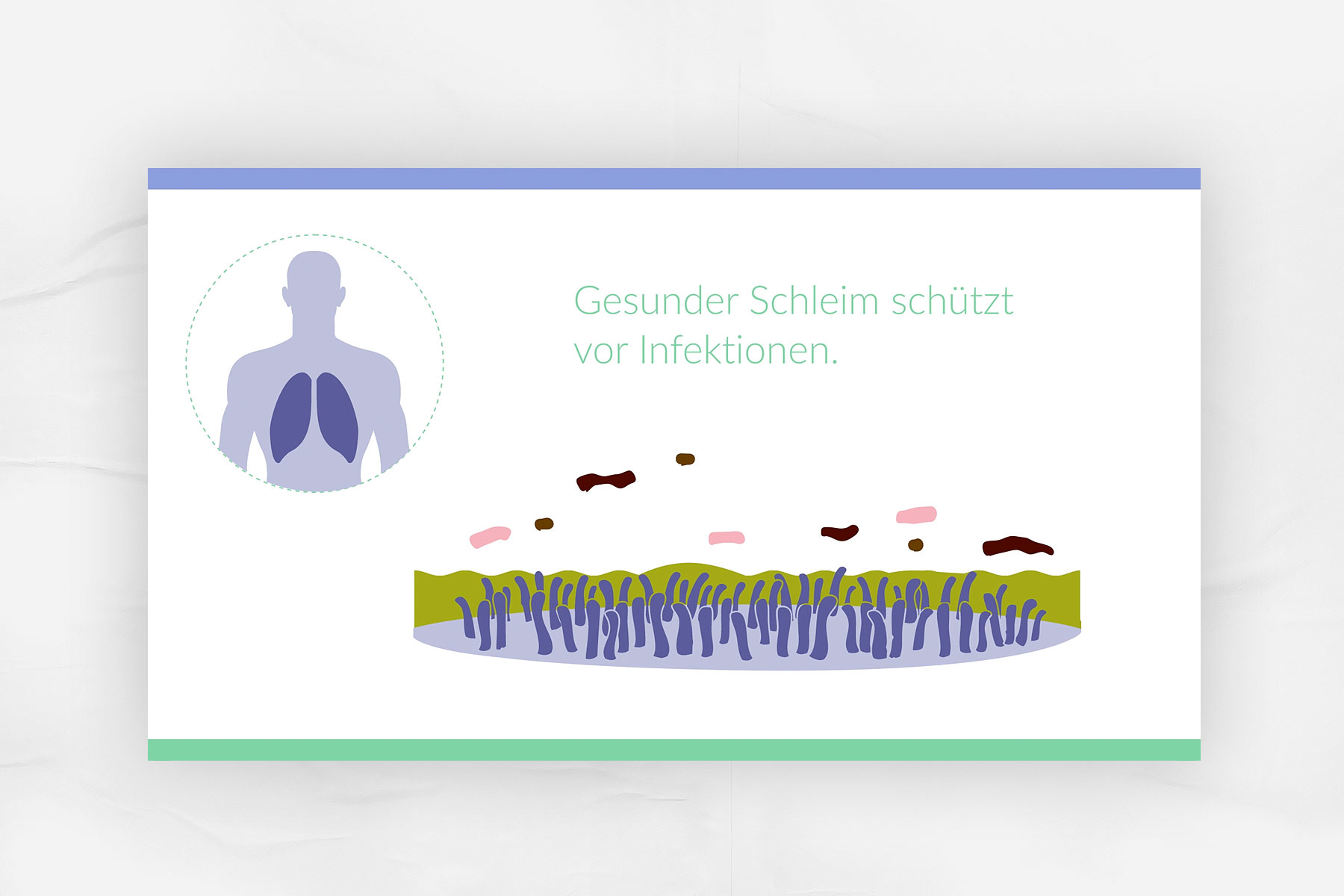 Beispiel Screen: Gesunder Schleim schützt vor Infektionen.
